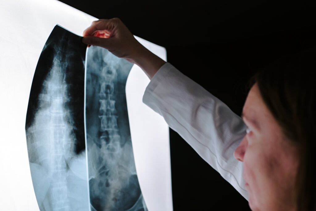 Female doctor examining spine x-ray in hospital office